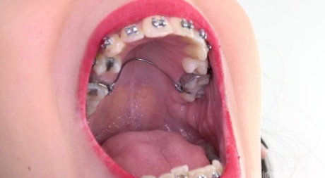 Morena con aparatos dentales se abre de par en par para ver de cerca su gran boca